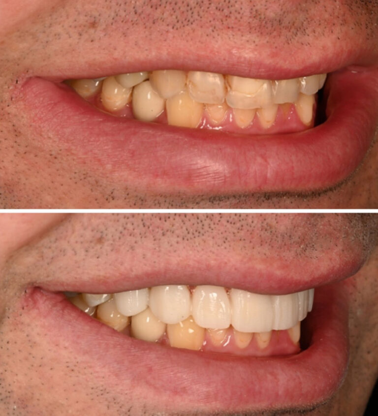 Before and After Photo 3
