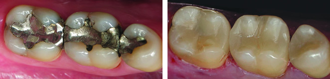ba-cerec-2