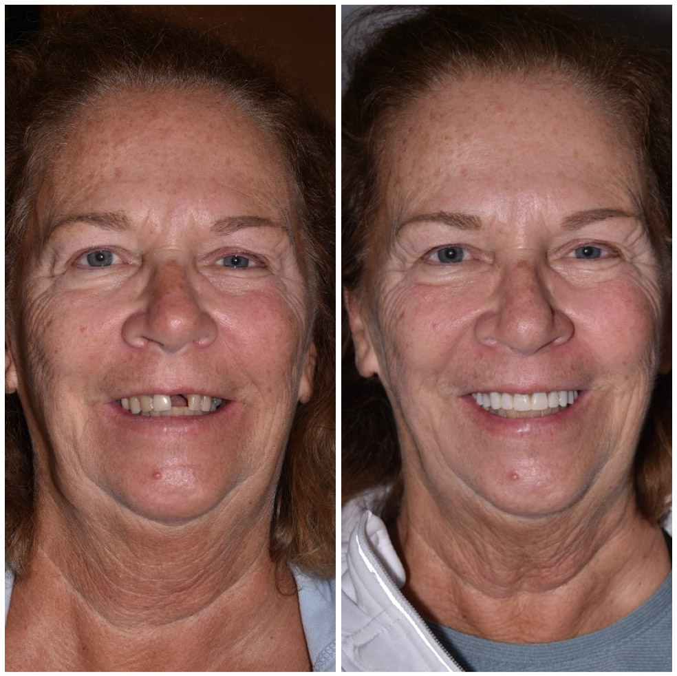 Patient Smile