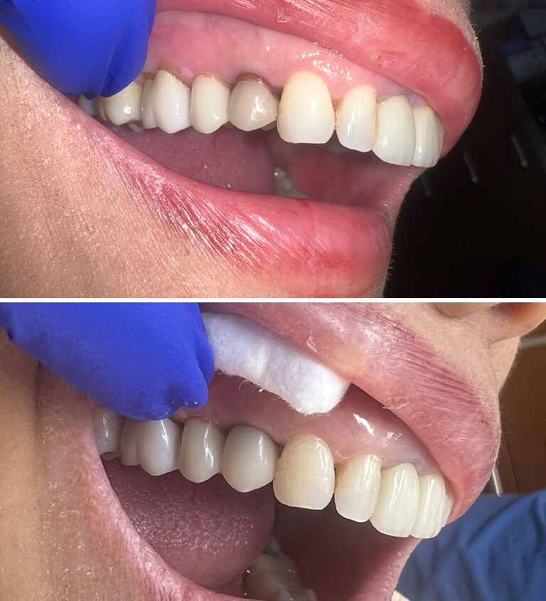 Before and After Photo 22