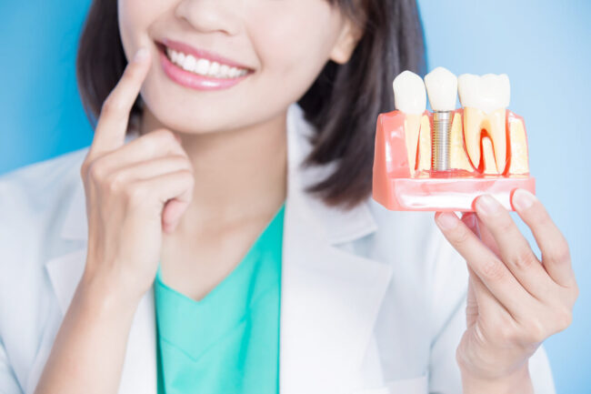 Woman dentist take implant tooth