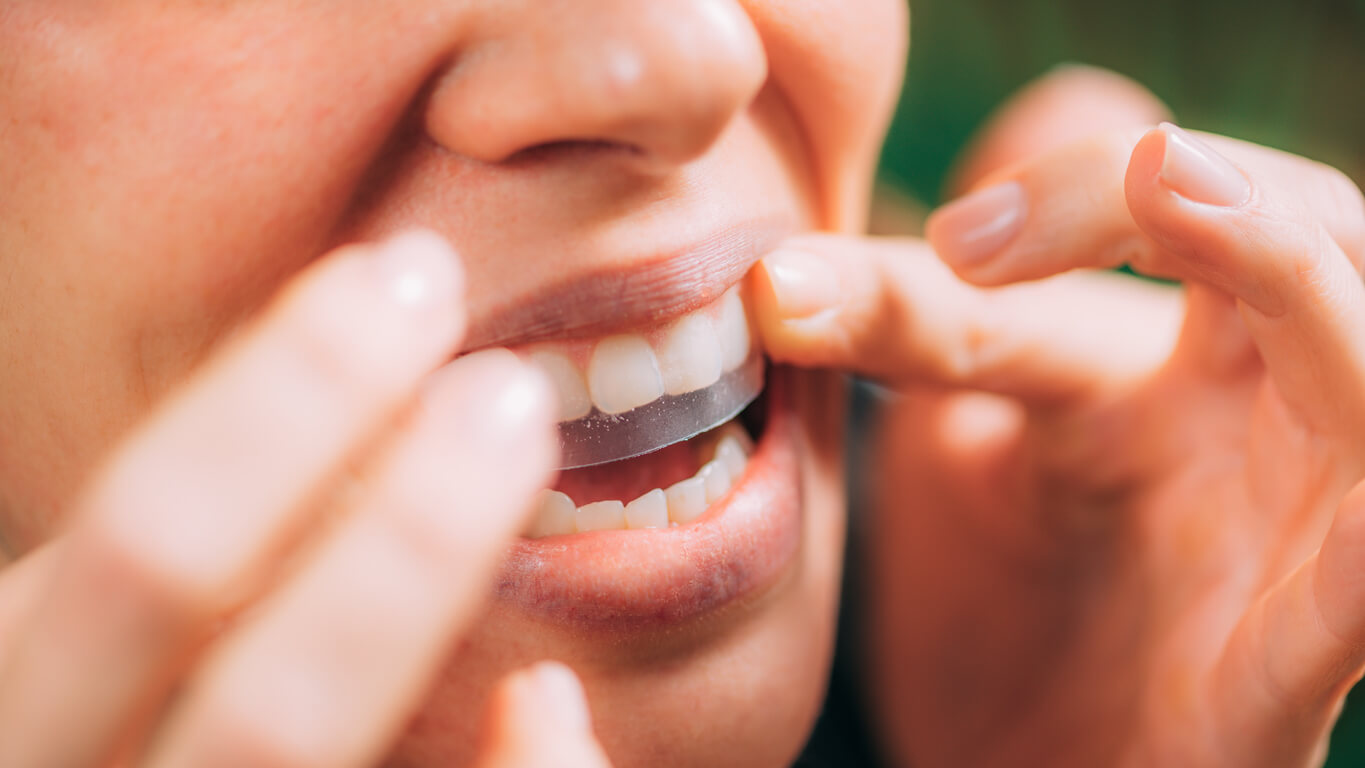 Teeth Whitening Strips Teeth Whitening Strips